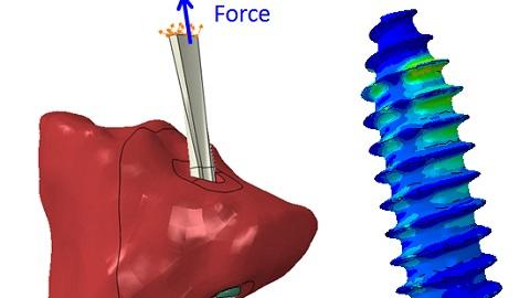 Bone Screw